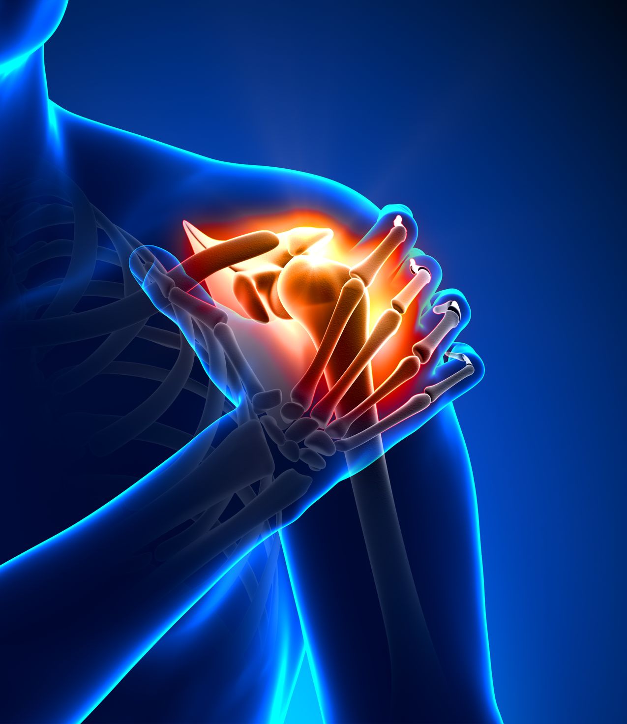 Shoulder Surgery – Biceps Tenodesis+ – The Lead-Up