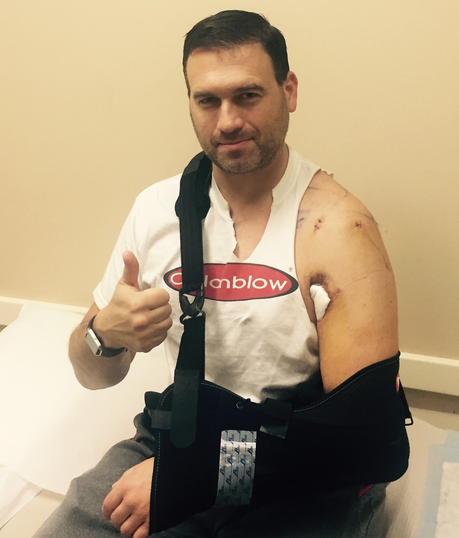 Shoulder surgery-biceps tenodesis+ – 1st post op