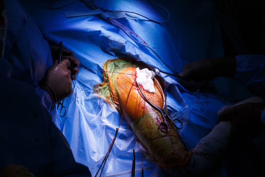 Shoulder Surgery – Biceps Tenodesis+ – Surgery Day